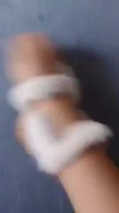 Face hug