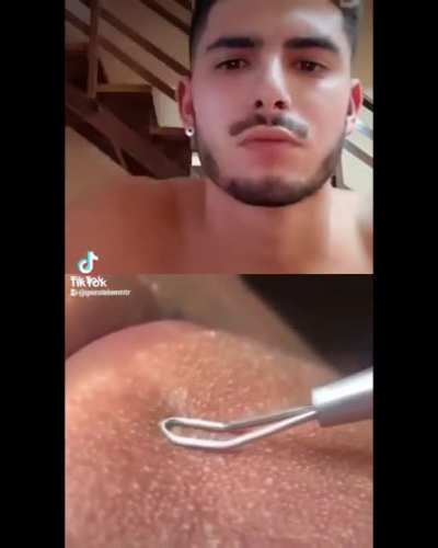 Puss Noodle