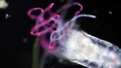 The microfibres from our plastic clothes end up among the plankton.