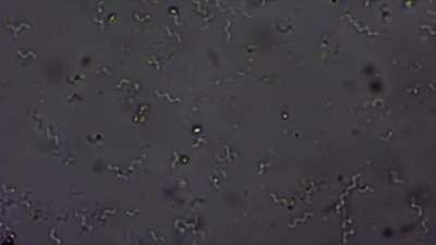 Spirilla bacteria before and after salt addition