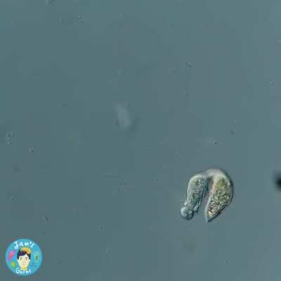 🔥 Vicious microscopic hunter, the single-cell organism, Lacrymaria olor, attacking and hunting another organism