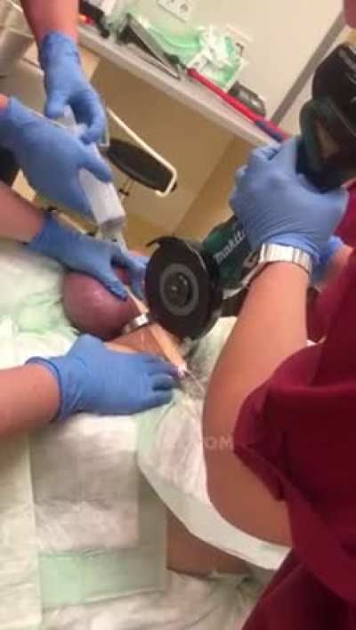 Cock ring removal.