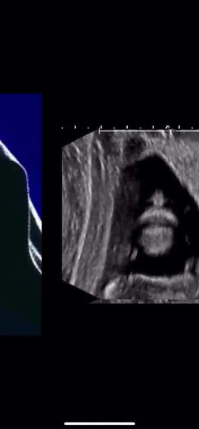 My wife is pregnant&hellip; with the Sith Lord?!?!