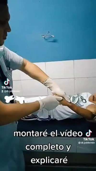 he broke his arm