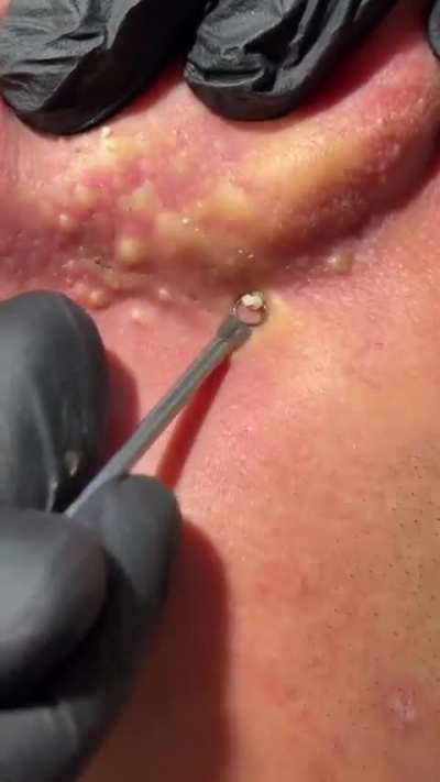.........