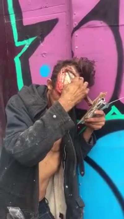 Guy combing his skull