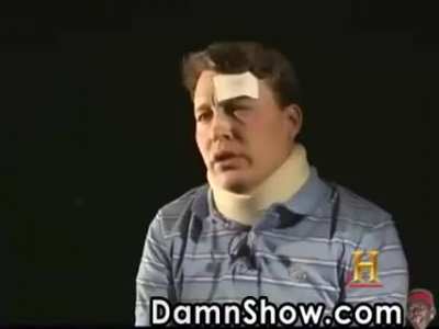 Midget supremacy