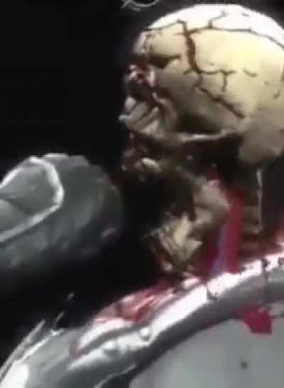 Fatality