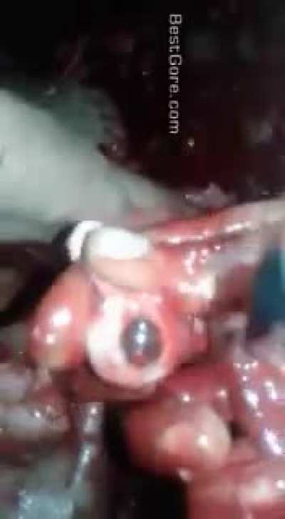 Worst shit Iv'e ever seen in my life