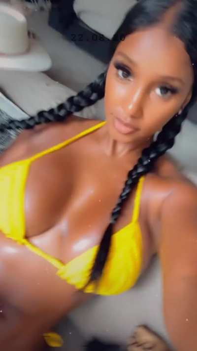 yellow fever