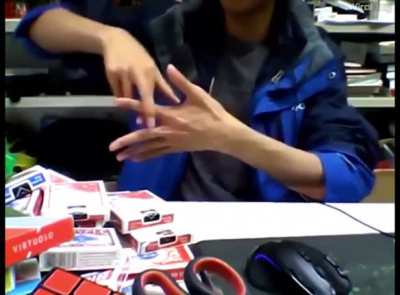 Whoa! This guy can remove his fingers!