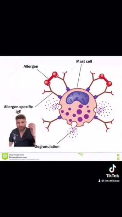 Hello guys, made a video about asthma for people that are curious about it, any constructive feedback is welcome 😌