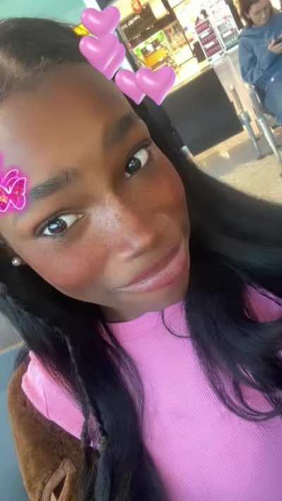 Girl gets forehead reduction surgery and it turned out like this&hellip;