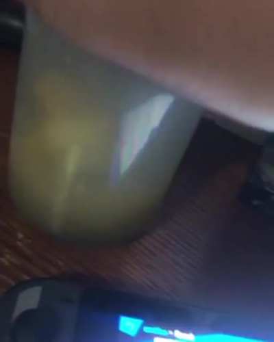 uh what’s inside that jar?