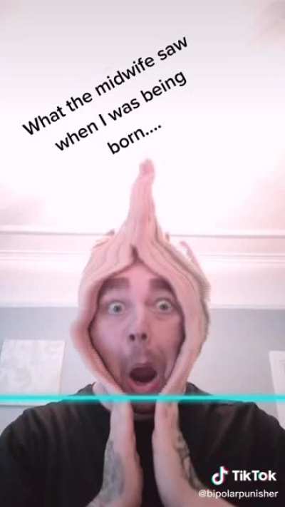 That&rsquo;s Looks Painful