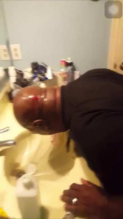 [TW Blood] He used a cheap razor to shave his head now they putting alcohol on it. bro i&rsquo;m so weak😭😭😭