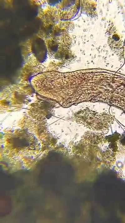 A Detritus Worm Munches on Some Algae! Look At Its Huge Mouth! I Was Also Able To Capture Other Parts Of The Process Of Digestion!