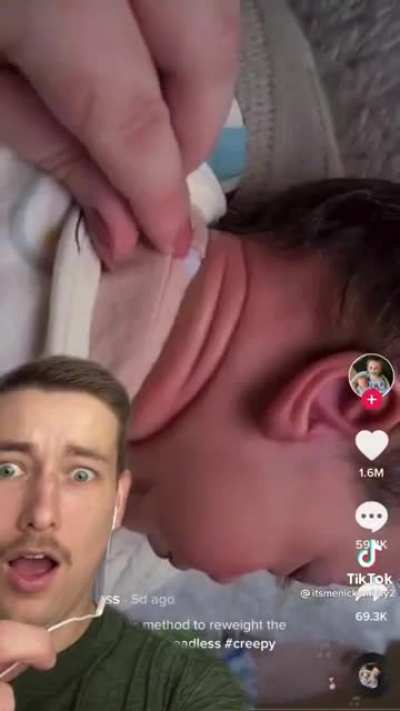 How to fix floppy headed babies