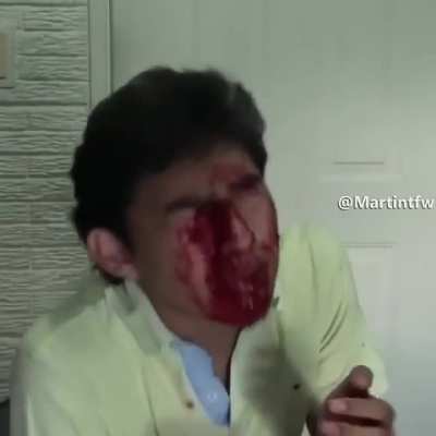 NOOO FERNAN