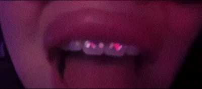 you don&rsquo;t need to see juicy titties or a fat ass &ndash; big lips and braces alone make your gooner cock leak