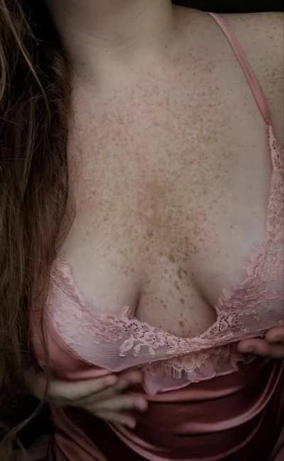do my freckles turn you on?