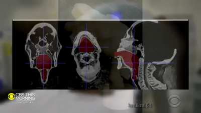 Voice of The Dead