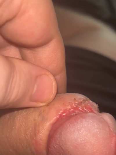 How&rsquo;s it looking? Should I be worried about anything? (Day 44) 