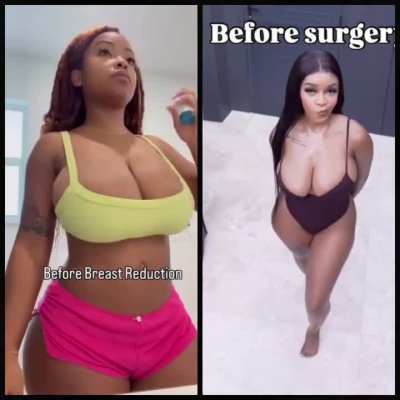 Left or Right