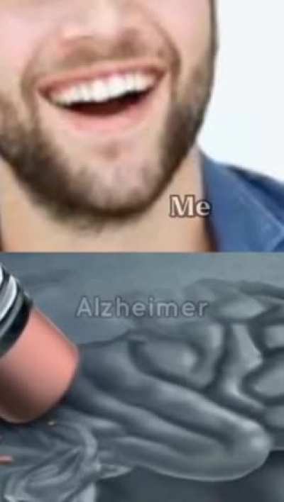 Me vs Alzheimer&rsquo;s