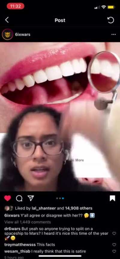 It disgusts me that we reached to a point where we can&rsquo;t even have normal teeth ffs