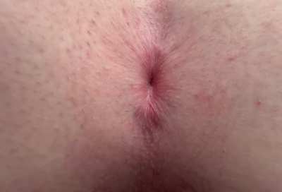 [18] How close is too close?