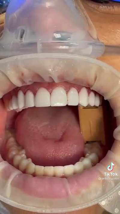 H2H Flossing