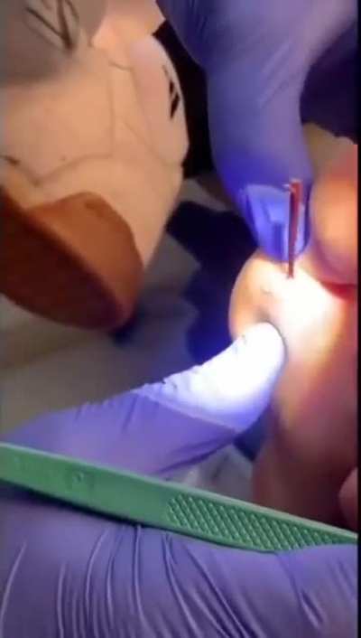 Splinter