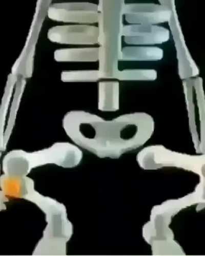 Confirmo yo estudi&eacute; anatom&iacute;a.