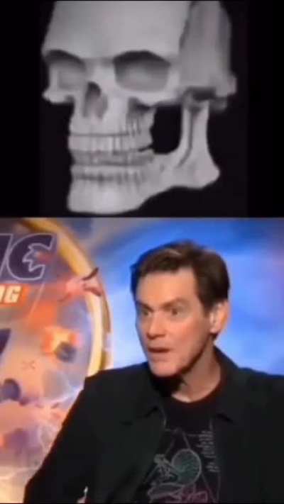 xray
