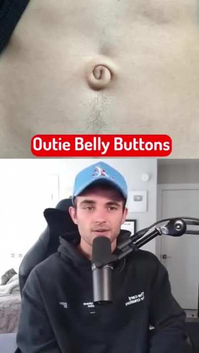 🤨😳