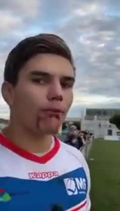 XD momento