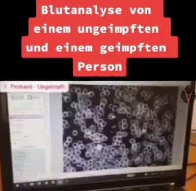 Video zum Post "Schaut auf das Blut"