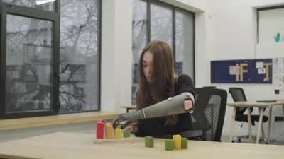 Prosthetic Bionic Arm