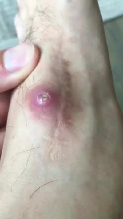 Alien bug