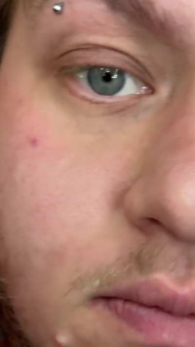 Weird gooey eyelash