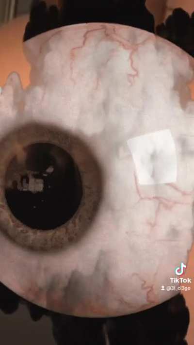 The Eye