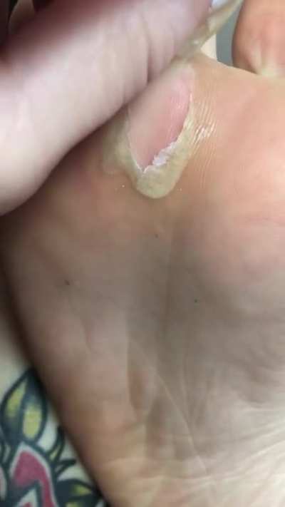Fuck it, posting on my main account. Here’s my foot
