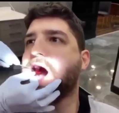 After tooth filling