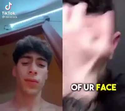 forehead