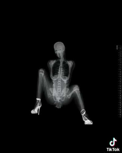 Want it?