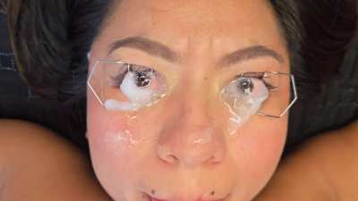 Eye speculum