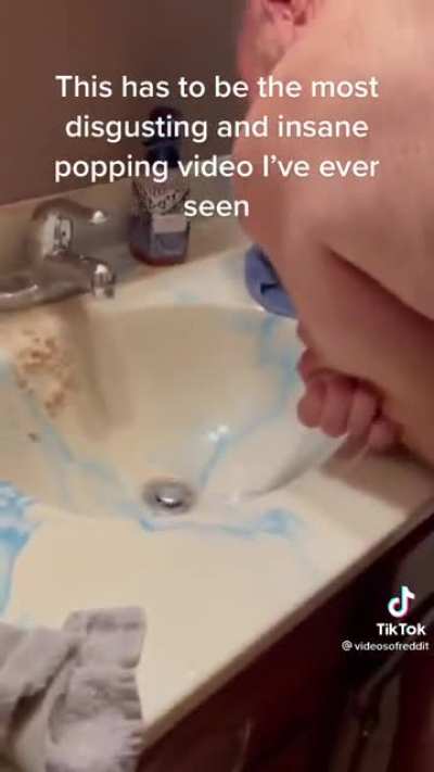 Absolutely disgusting cyst on dudes arm being popped
