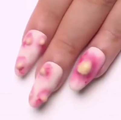 Pimple nails for some reason