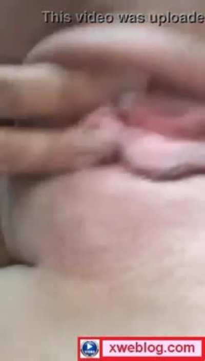 Vaginota